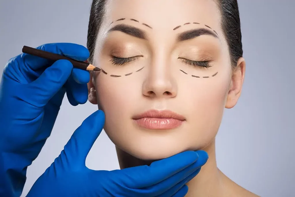 Blefaroplastia: cuidados posteriores para darte mejores resultados de tu cirugía y mantener tu mirada rejuvenecida. 